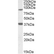 abx432242 (1 µg/ml) staining of Frontal Cortex lysate (35 µg protein in RIPA buffer). Primary incubation was 1 hour. Detected by chemiluminescence.