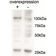 Cell line 143B overexpressing Human AARS2 and probed with abx432253 (mock transfection in second lane).