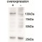 Alanine--TRNA Ligase, Mitochondrial (AARS2) Antibody