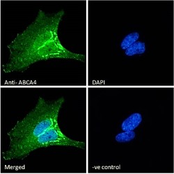 Retinal-Specific ATP-Binding Cassette Transporter (ABCA4) Antibody