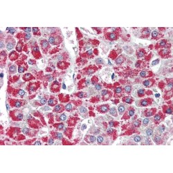Acyl-CoA Dehydrogenase, C-4 To C-12 Straight Chain (ACADM) Antibody