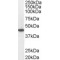Acyl-CoA Dehydrogenase, C-4 To C-12 Straight Chain (ACADM) Antibody