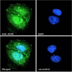 Acetylcholinesterase (AChE) Antibody