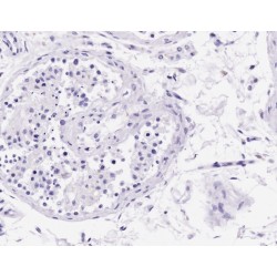 Acrosin light chain Antibody