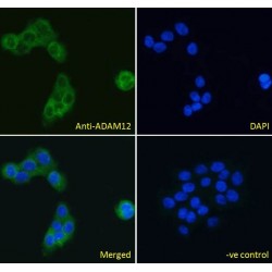 ADAM Metallopeptidase Domain 12 (ADAM12) Antibody