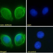 abx432288