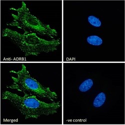 Beta-1 Adrenergic Receptor (ADRB1) Antibody