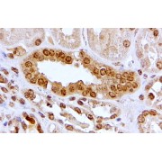 abx432291