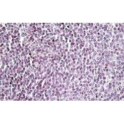 Absent In Melanoma 2 (AIM2) Antibody