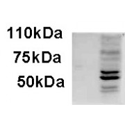 abx432297 (1 µg/ml) staining of IFNbeta-treated WI-38 lysate (35 µg protein in RIPA buffer). Primary incubation was 1 hour. Detected by chemiluminescence.
