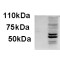 Absent In Melanoma 2 (AIM2) Antibody