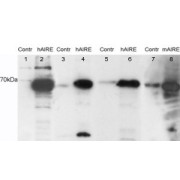abx432298