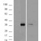 Aldo-Keto Reductase Family 1 Member B10 (AKR1B10) Antibody