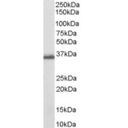 abx432302