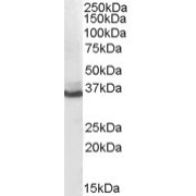 abx432303