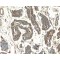 RAC-Beta Serine/threonine-Protein Kinase (AKT2) Antibody