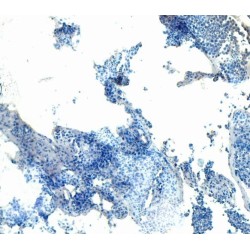 RAC-Beta Serine/threonine-Protein Kinase (AKT2) Antibody