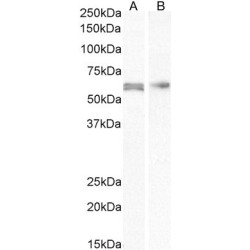 RAC-Beta Serine/threonine-Protein Kinase (AKT2) Antibody