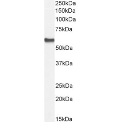 RAC-Beta Serine/threonine-Protein Kinase (AKT2) Antibody