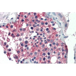 Retinal Dehydrogenase 1 (ALDH1A1) Antibody