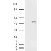 HEK293 overexpressing ALDH1A1 and probed with abx432306 (mock transfection in first lane).