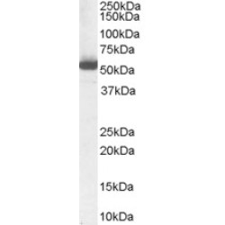 Retinal Dehydrogenase 1 (ALDH1A1) Antibody