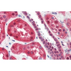 Polyunsaturated Fatty Acid Lipoxygenase ALOX15 (ALOX15) Antibody