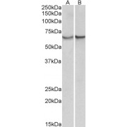 abx432313 (0.3 µg/ml) staining of albumin-depleted Serum (A) and Plasma (B) lysates (35 µg protein in RIPA buffer). Primary incubation was 1 hour. Detected by chemiluminescence.