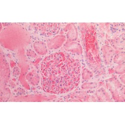 Alpha Fetoprotein (AFP) Antibody