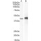 Alpha-Methylacyl-CoA Racemase (AMACR) Antibody