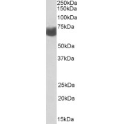 abx432322