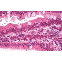 Apolipoprotein B (APOB) Antibody