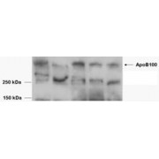 abx432338 (0.5 µg/ml) staining of Human Serum lysates. Data kindly provided by Yan Xie and NO Davidson, Washington USA. This antibody showed background below 150kDa in serum samples.