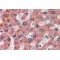 Apolipoprotein C-I (APOC1) Antibody