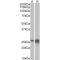 Apolipoprotein D (APOD) Antibody