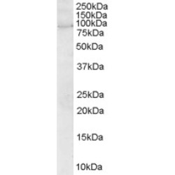 Rho Guanine Nucleotide Exchange Factor 4 (ARHGEF4) Antibody