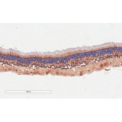 Age-Related Maculopathy Susceptibility Protein 2 (ARMS2) Antibody