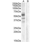 abx432369 (0.3 µg/ml) staining of A459 lysate (35 µg protein in RIPA buffer) with (B) and without (A) blocking with the immunising peptide. Primary incubation was 1 hour. Detected by chemiluminescence.