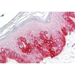 Autophagy-Related Protein 16-1 (ATG16L1) Antibody