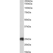 abx432380 (0.03 µg/ml) staining of Human Heart lysate (35 µg protein in RIPA buffer). Detected by chemiluminescence.