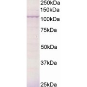 abx432398