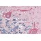 Bcl-2-Like Protein 15 (BCL2L15) Antibody