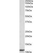 abx432404 (0.03 µg/ml) staining of Human Duodenum lysate (35 µg protein in RIPA buffer). Primary incubation was 1 hour. Detected by chemiluminescence.