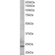 abx432408 staining (0.5 µg/ml) of K562 lysate (RIPA buffer, 35 µg total protein per lane). Primary incubated for 1 hour. Detected by western blot using chemiluminescence.