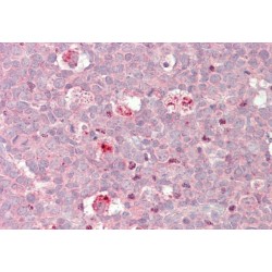 Baculoviral IAP Repeat-Containing Protein 3 (BIRC3) Antibody