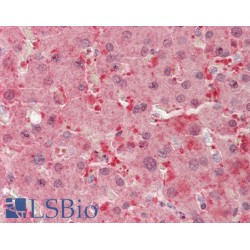 Biliverdin Reductase B (BLVRB) Antibody