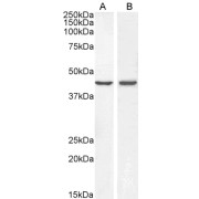 abx432418 (0.3 µg/ml) staining of A431 (A) and HeLa (B) lysate (35 µg protein in RIPA buffer). Primary incubation was 1 hour. Detected by chemiluminescence.