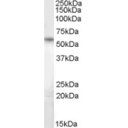 abx432425 (1 µg/ml) staining of Human Heart lysate (35 µg protein in RIPA buffer). Primary incubation was 1 hour. Detected by chemiluminescence.