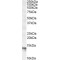 Nuclear Nucleic Acid-Binding Protein C1D (C1D) Antibody