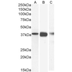 Macrophage-Capping Protein (CAPG) Antibody